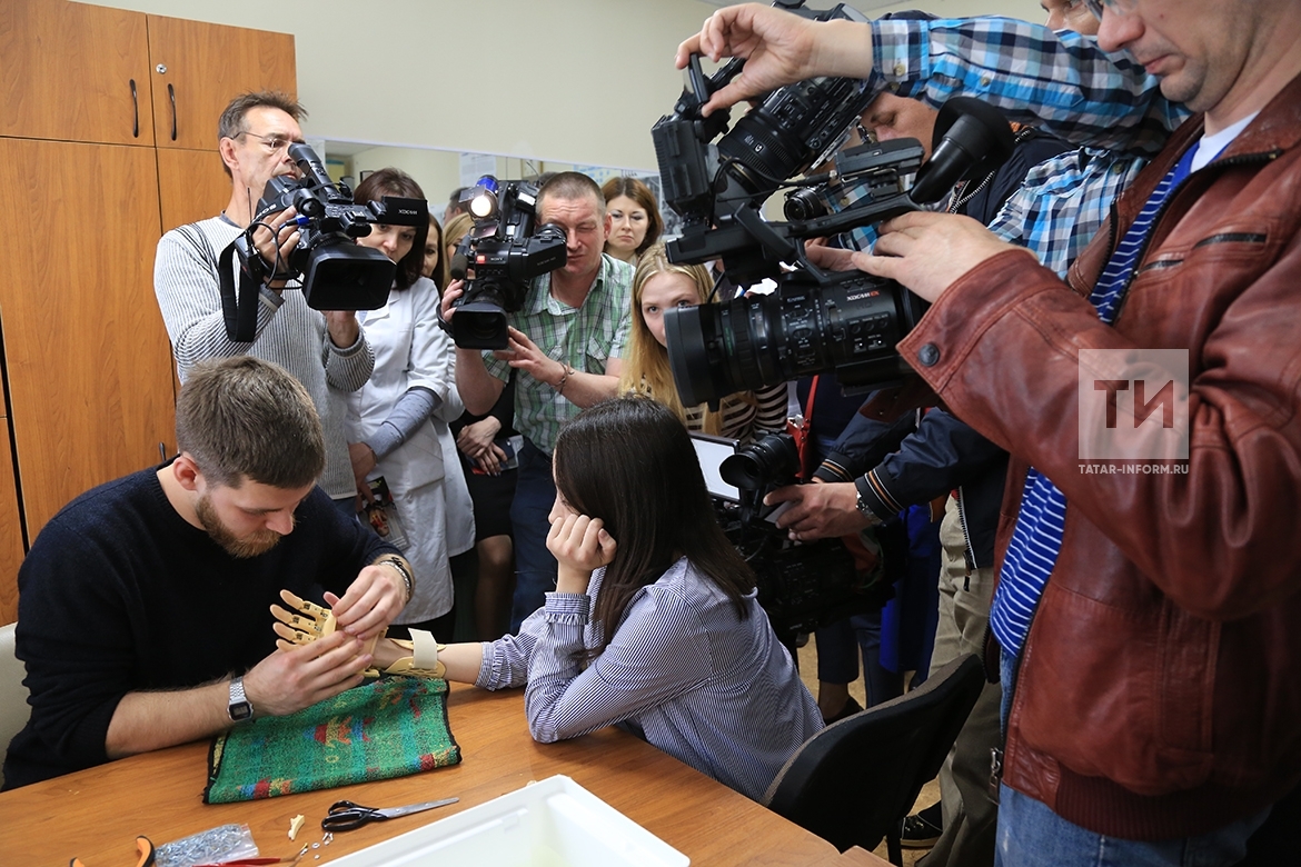 В Казани устанавливают напечатанный на 3D-принтере протез руки