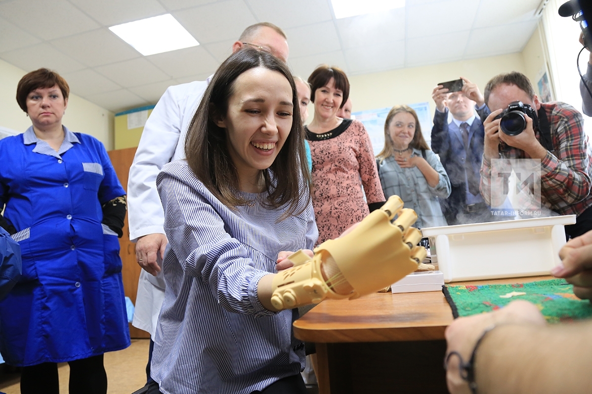 В Казани устанавливают напечатанный на 3D-принтере протез руки